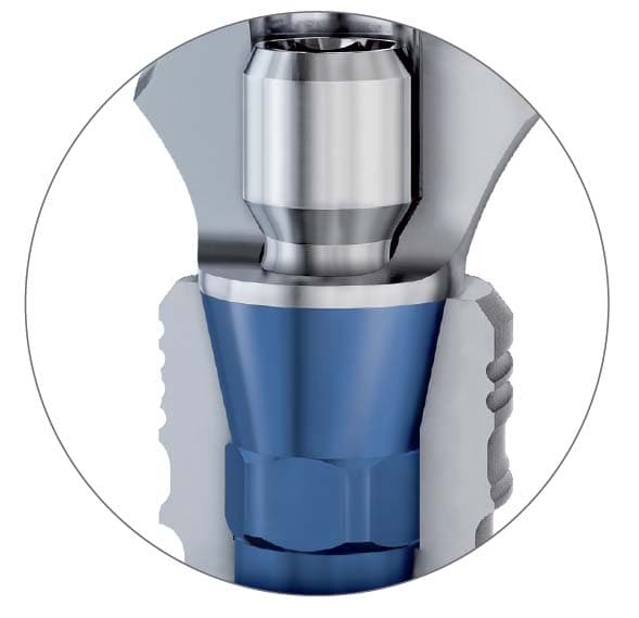 Q-Lock® spojení BioniQ®